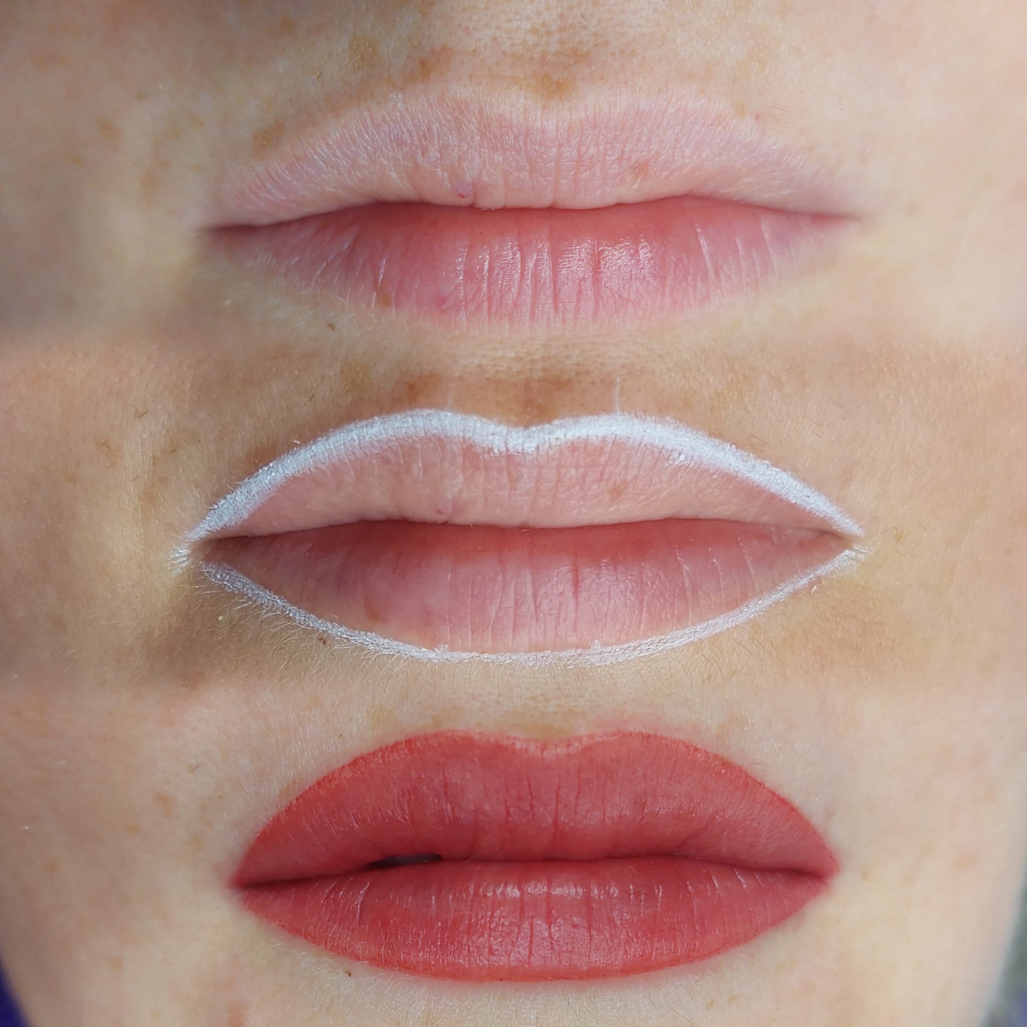 Dudak Pigmentasyonu: Canlı ve Belirgin Dudaklar