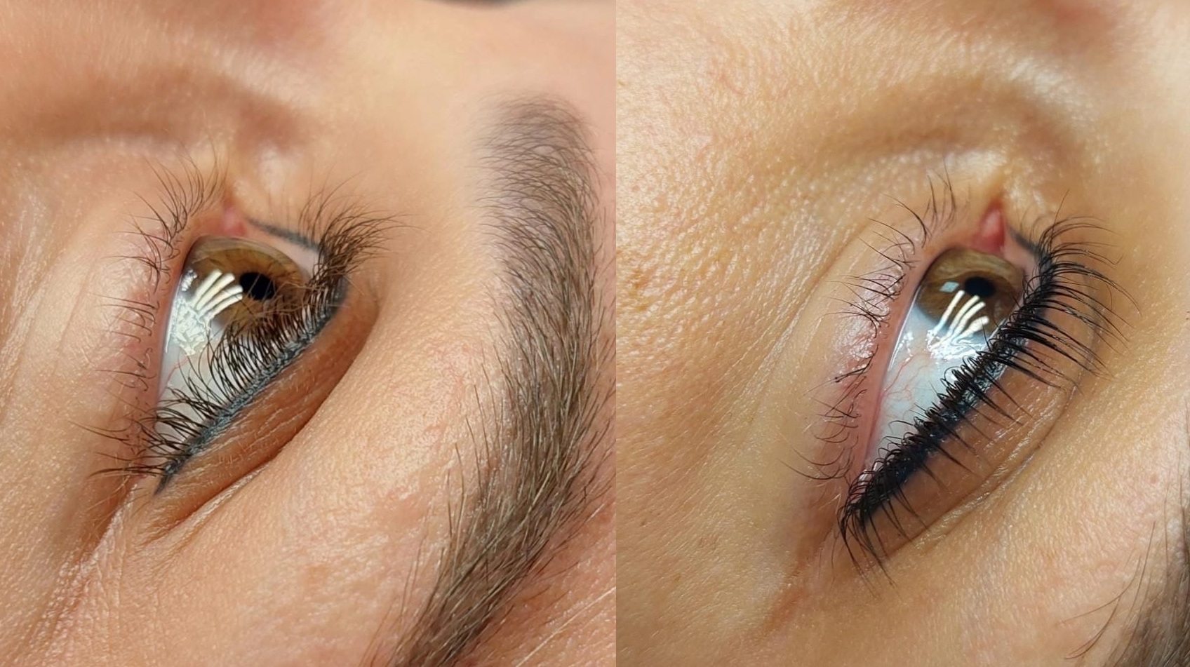 Kirpik Lifting: Kıvrık ve Belirgin Kirpikler